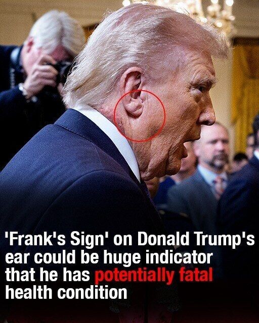 ‘Frank’s Sign’ on Trump’s ear could be huge indicator of potentially fatal health condition