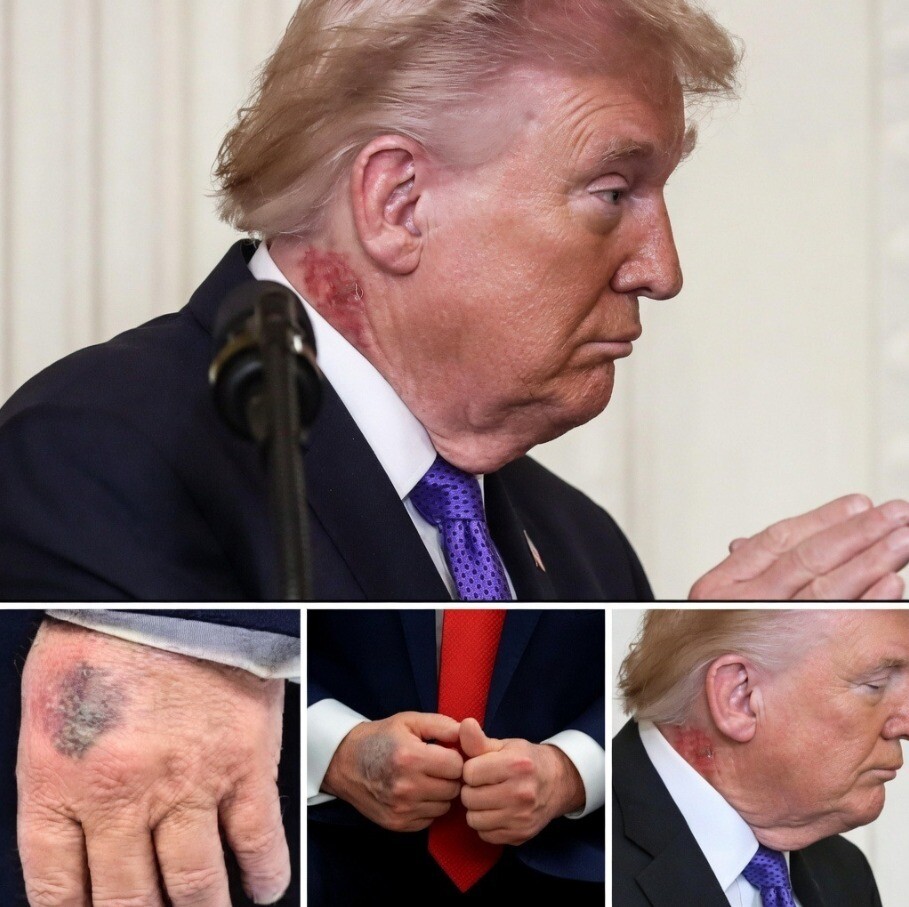 Reports Concerning Donald Trump’s Health Gain Attention Following Schedule Changes